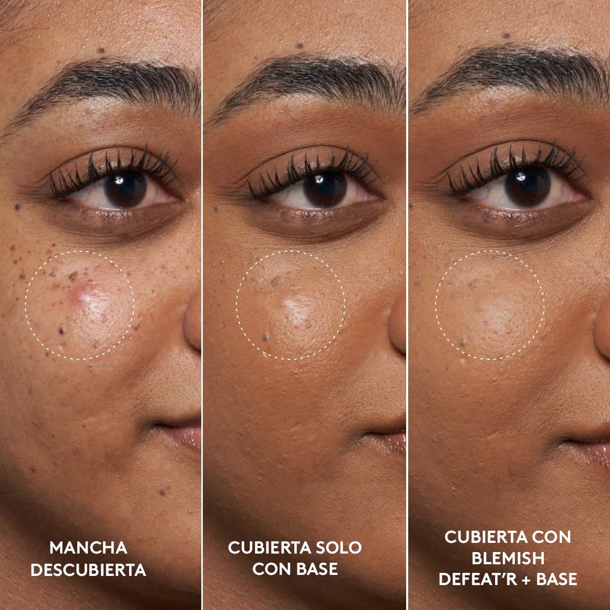BLEMISH DEFEAT'R BHA SPOT TARGETING GEL (GEL FACIAL CON &Aacute;CIDO SALIC&Iacute;LICO)